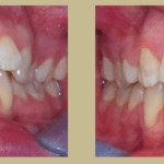 Orthodontics at Cornerhouse Dental